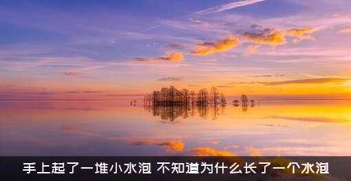 手上起了一堆小水泡（不知道为什么长了一个水泡）